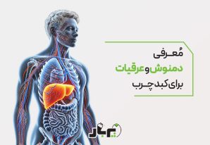 معرفی دمنوش و عرقیجات برای کبد چرب